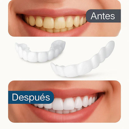 Set Carillas Dentales EasySmile [TU SONRISA PERFECTA]